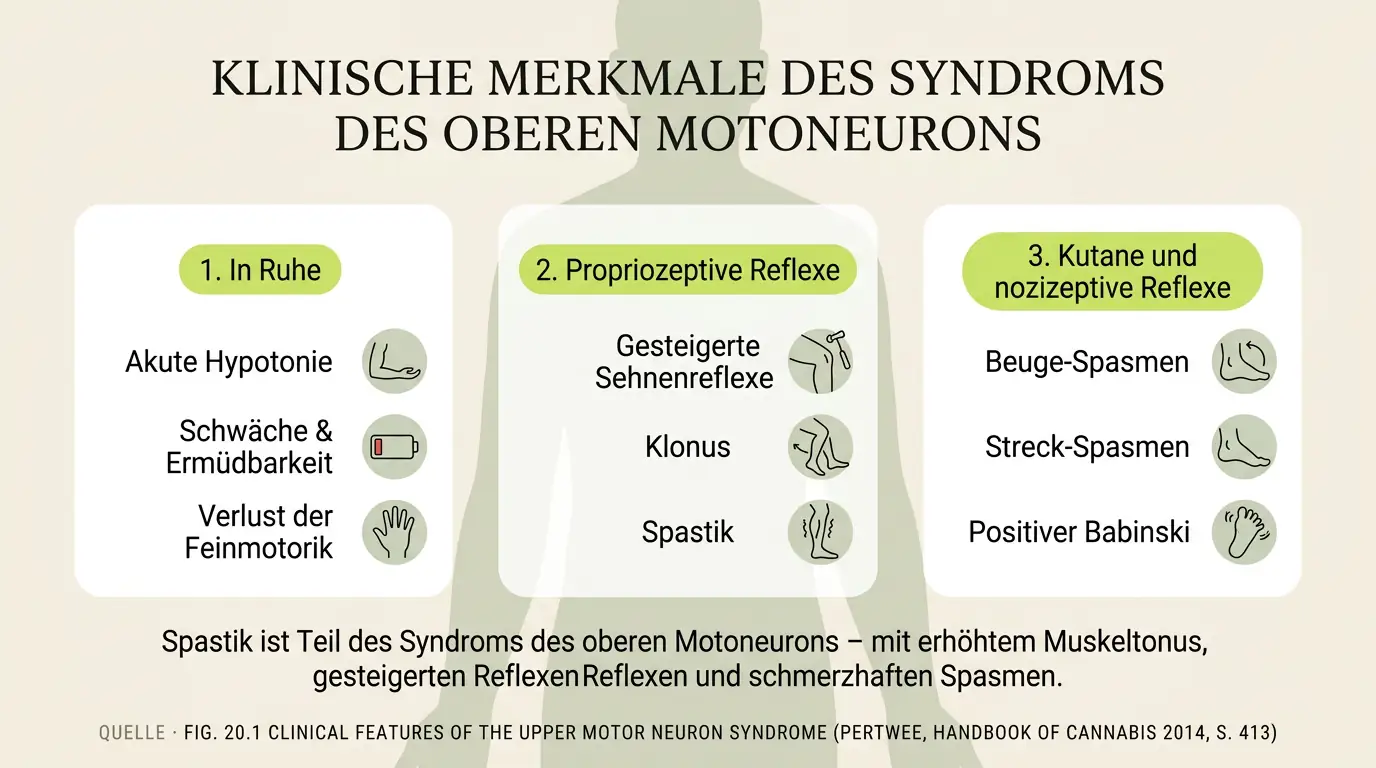 Schema des Syndroms des oberen Motoneurons mit den klinischen Merkmalen einer Spastik